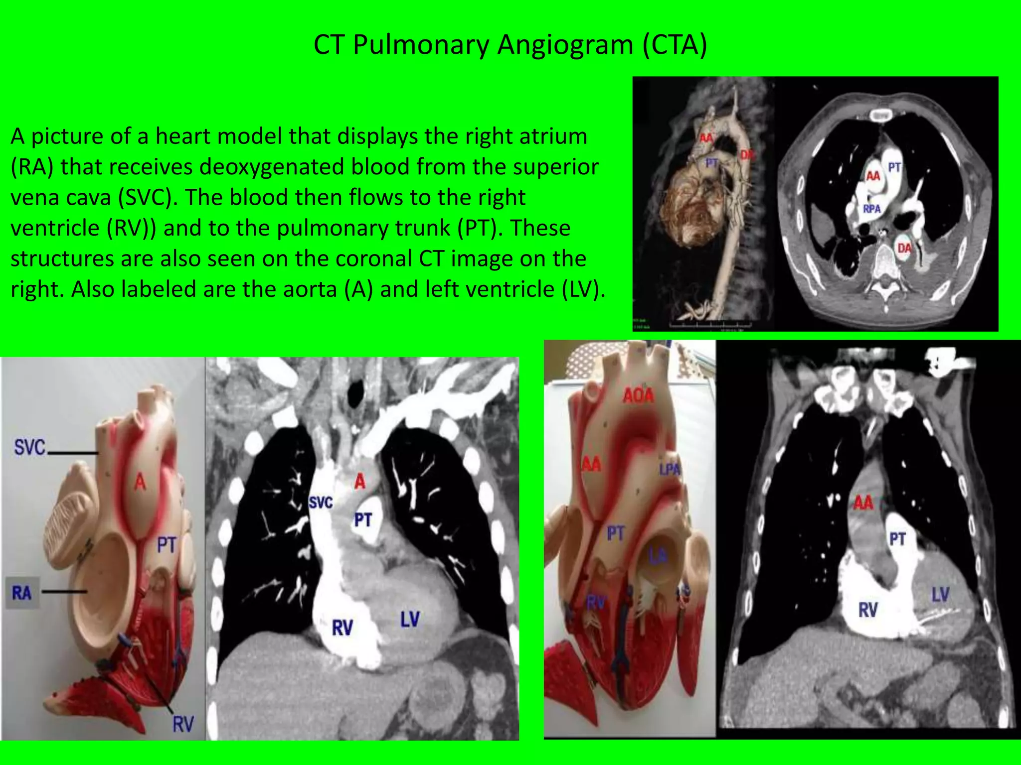 Vascular Shape Vascular structure thorax and abdomen. Almas khan Khorfakkhan hospital ...