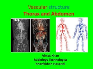 Vascular structure
Thorax and Abdomen
Almas Khan
Radiology Technologist
Khorfakhan Hospital
 