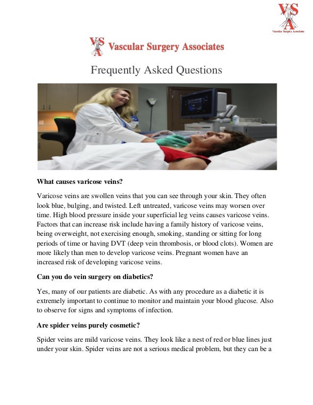 Vascular surgery frequently asked questions