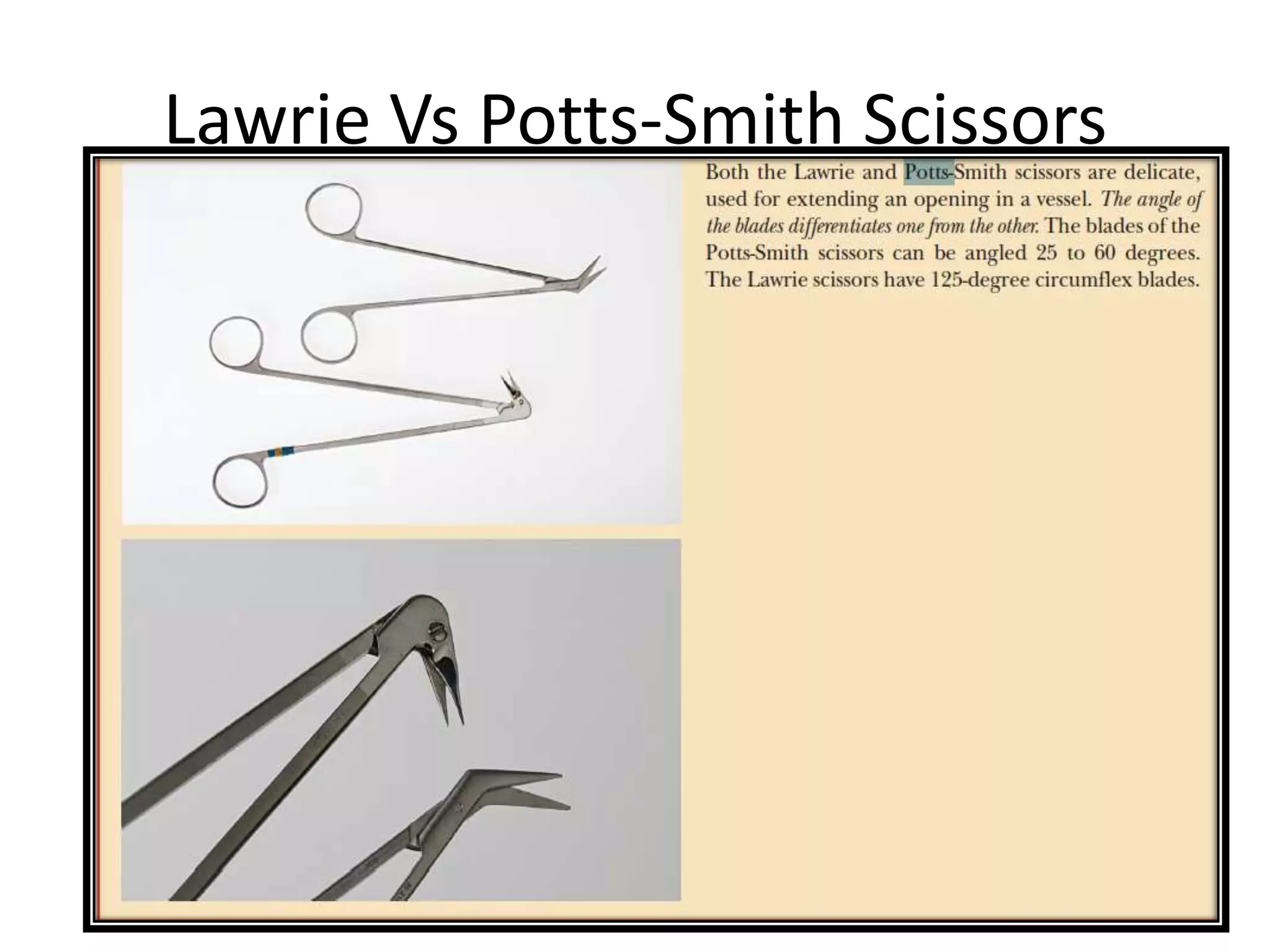 Lawrie Vs Potts-Smith Scissors
 