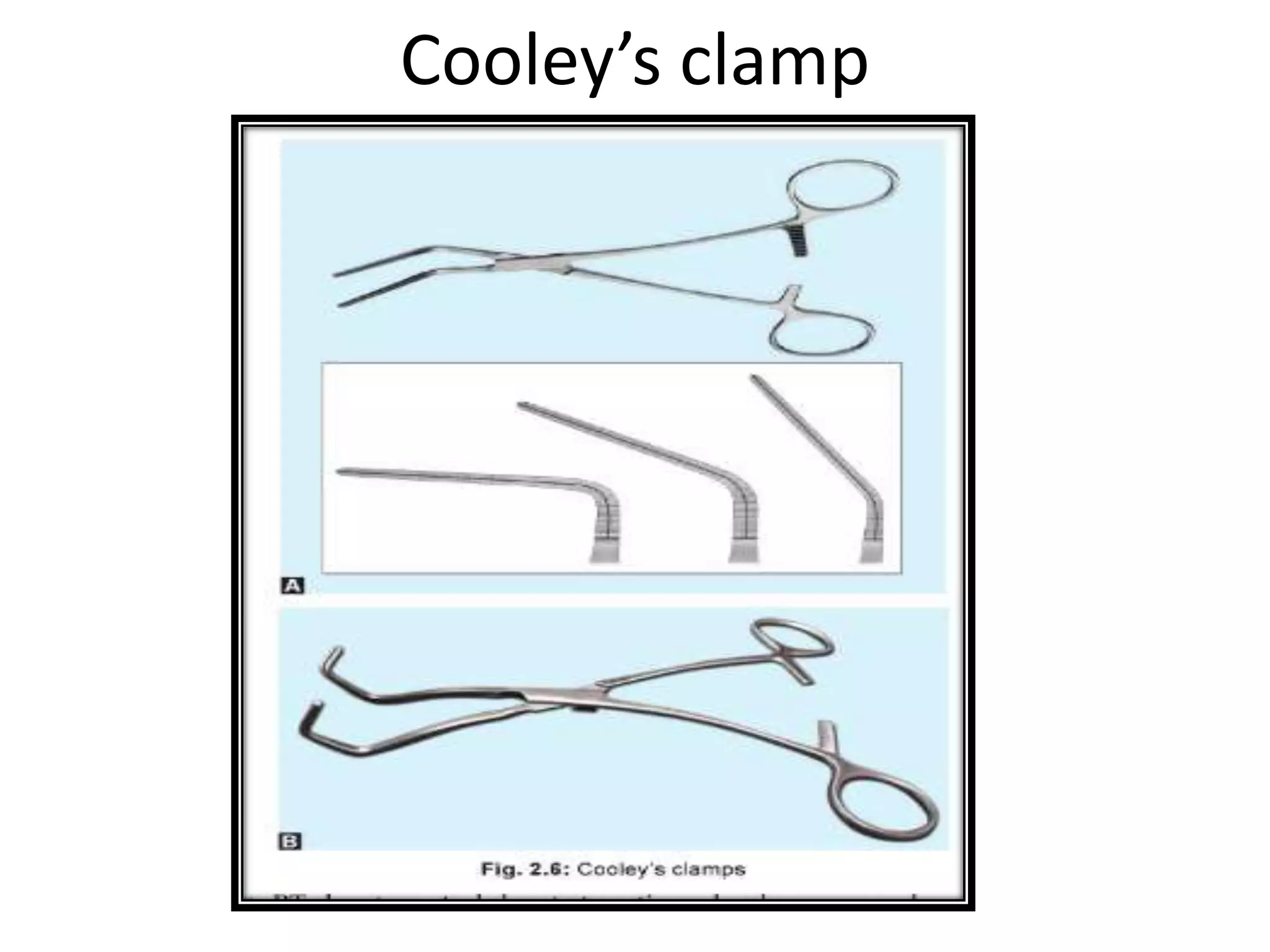 Cooley’s clamp
 
