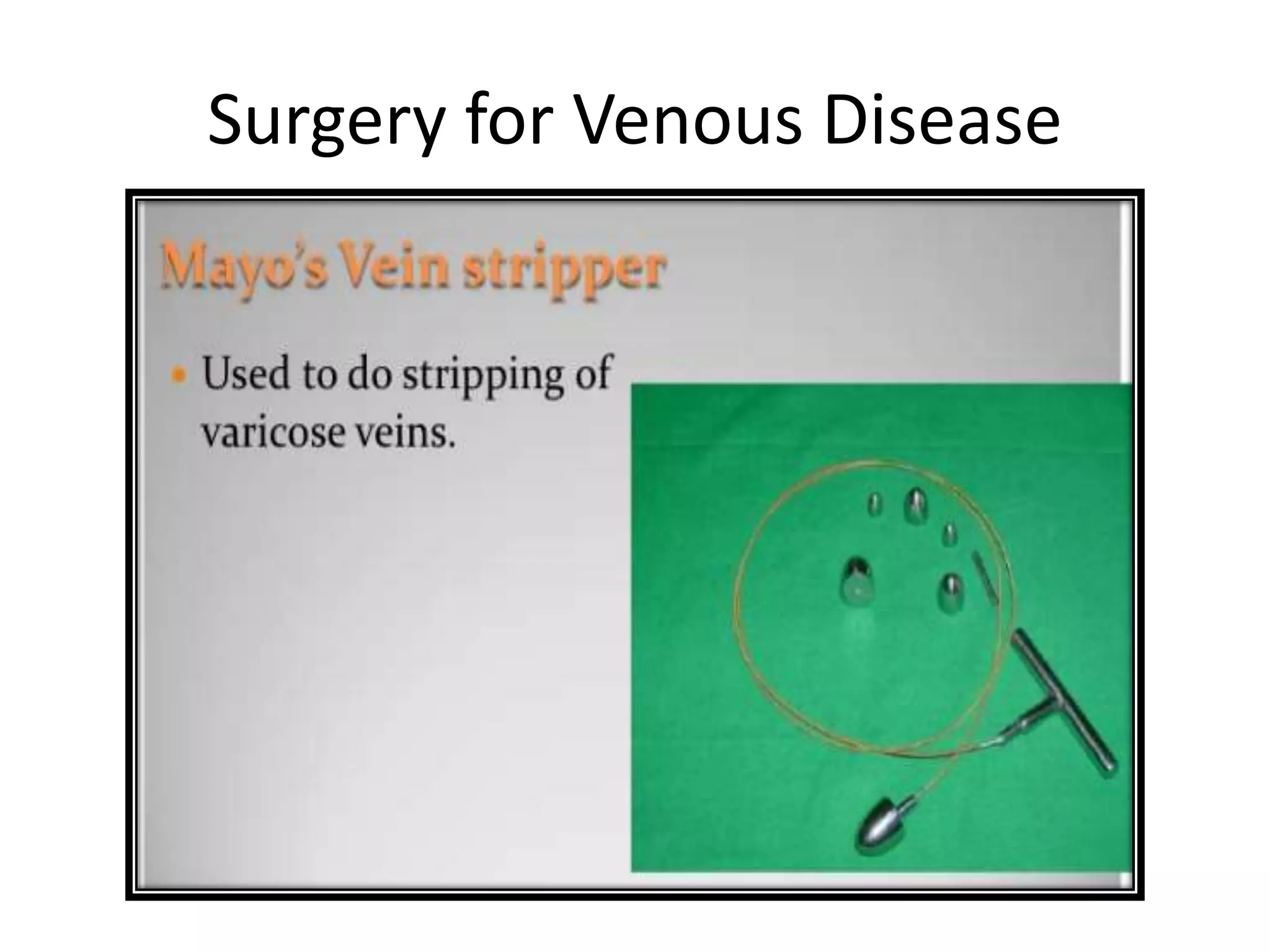 Surgery for Venous Disease
 