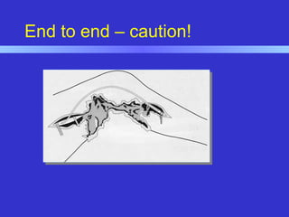 End to end – caution!
 