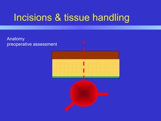 Incisions & tissue handling
Anatomy
preoperative assessment
 