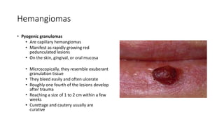 Hemangiomas
• Pyogenic granulomas
• Are capillary hemangiomas
• Manifest as rapidly growing red
pedunculated lesions
• On the skin, gingival, or oral mucosa
• Microscopically, they resemble exuberant
granulation tissue
• They bleed easily and often ulcerate
• Roughly one fourth of the lesions develop
after trauma
• Reaching a size of 1 to 2 cm within a few
weeks
• Curettage and cautery usually are
curative
 