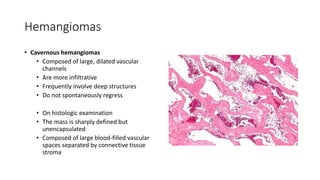 Hemangiomas
• Cavernous hemangiomas
• Composed of large, dilated vascular
channels
• Are more infiltrative
• Frequently involve deep structures
• Do not spontaneously regress
• On histologic examination
• The mass is sharply defined but
unencapsulated
• Composed of large blood-filled vascular
spaces separated by connective tissue
stroma
 