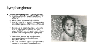 Lymphangiomas
• Cavernous lymphangiomas (cystic hygromas)
• Typically are found in the neck or axilla of
children
• More rarely in the retroperitoneum
• Can be large (up to 15 cm), filling the axilla
or producing gross deformities of the neck
• Composed of massively dilated lymphatic
spaces lined by endothelial cells and
separated by intervening connective tissue
stroma containing lymphoid aggregates
• The tumor margins are indistinct and
unencapsulated, making definitive
resection difficult.
• Of note, cavernous lymphangiomas of the
neck are common in Turner syndrome.
 