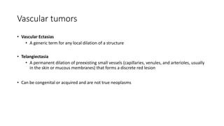 Vascular tumors
• Vascular Ectasias
• A generic term for any local dilation of a structure
• Telangiectasia
• A permanent dilation of preexisting small vessels (capillaries, venules, and arterioles, usually
in the skin or mucous membranes) that forms a discrete red lesion
• Can be congenital or acquired and are not true neoplasms
 