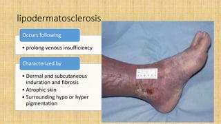 Vascular ulcer.pptx