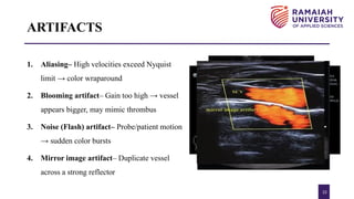 Vascular Ultrasound and Colour Doppler.pptx