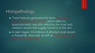  These features generated the term cutaneous
necrotizing vasculitis (CNV), which refers to
leukocytoclastic vasculitis affecting the small and
medium vessels that supply nutrients to the skin.
 In later stages, thrombosis of affected small vessels
is frequently observed, as well as hyalinization and
fibrosis of vessel walls.
Dr.GamalSultan
 