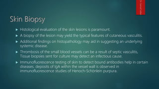  Histological evaluation of the skin lesions is paramount.
 A biopsy of the lesion may yield the typical features of cutaneous vasculitis.
 Additional findings on histopathology may aid in suggesting an underlying
systemic disease.
 Thrombosis of the small blood vessels can be a result of septic vasculitis,
Tissue biopsies sent for culture may detect an infectious cause.
 Immunofluorescence testing of skin to detect bound antibodies help in certain
diseases. deposits of IgA within the vessel wall is observed in
immunofluorescence studies of Henoch-Schönlein purpura.
Dr.GamalSultan
 