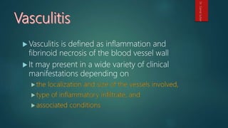  Vasculitis is defined as inflammation and
fibrinoid necrosis of the blood vessel wall
 It may present in a wide variety of clinical
manifestations depending on
Dr.GamalSultan
 