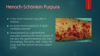  is the most common vasculitis in
children.
 an acute immunoglobulin A (IgA)–
mediated disorder
 characterized by a generalized
vasculitis involving the small vessels of
the skin, the gastrointestinal (GI) tract,
the kidneys, the joints, and, rarely, the
lungs and the central nervous system
(CNS)
Dr.GamalSultan
 