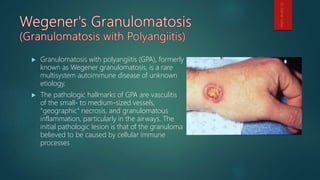  Granulomatosis with polyangiitis (GPA), formerly
known as Wegener granulomatosis, is a rare
multisystem autoimmune disease of unknown
etiology.
 The pathologic hallmarks of GPA are vasculitis
of the small- to medium-sized vessels,
"geographic" necrosis, and granulomatous
inflammation, particularly in the airways. The
initial pathologic lesion is that of the granuloma
believed to be caused by cellular immune
processes
 