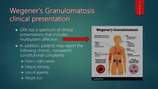  GPA has a spectrum of clinical
presentations that includes
multisystem affection
 In addition, patients may report the
following chronic, nonspecific
constitutional complaints:
 Fevers, night sweats
 Fatigue, lethargy
 Loss of appetite
 Weight loss
Dr.GamalSultan
 