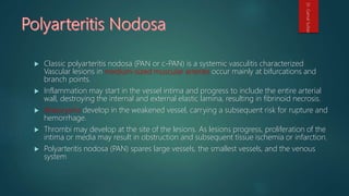  Classic polyarteritis nodosa (PAN or c-PAN) is a systemic vasculitis characterized
Vascular lesions in medium-sized muscular arteries occur mainly at bifurcations and
branch points.
 Inflammation may start in the vessel intima and progress to include the entire arterial
wall, destroying the internal and external elastic lamina, resulting in fibrinoid necrosis.
 Aneurysms develop in the weakened vessel, carrying a subsequent risk for rupture and
hemorrhage.
 Thrombi may develop at the site of the lesions. As lesions progress, proliferation of the
intima or media may result in obstruction and subsequent tissue ischemia or infarction.
 Polyarteritis nodosa (PAN) spares large vessels, the smallest vessels, and the venous
system
Dr.GamalSultan
 