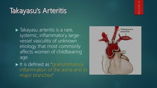 Takayasu arteritis is a rare,
systemic, inflammatory large-
vessel vasculitis of unknown
etiology that most commonly
affects women of childbearing
age.
 It is defined as "granulomatous
inflammation of the aorta and its
major branches"
Dr.GamalSultan
 
