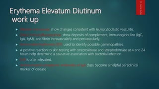  Electron microscopy show changes consistent with leukocytoclastic vasculitis.
 Direct immunofluorescence show deposits of complement, immunoglobulins (IgG,
IgA, IgM), and fibrin intravascularly and perivascularly.
 Immunoelectrophoresis (IEP) used to identify possible gammopathies.
 A positive reaction to skin testing with streptokinase and streptodornase at 4 and 24
hours help determine a causative association with bacterial infection.
 ESR is often elevated.
 Antineutrophil cytoplasmic antibodies of IgA class become a helpful paraclinical
marker of disease
Dr.GamalSultan
 