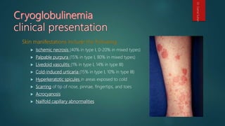  Ischemic necrosis (40% in type I, 0-20% in mixed types)
 Palpable purpura (15% in type I, 80% in mixed types)
 Livedoid vasculitis (1% in type I, 14% in type III)
 Cold-induced urticaria (15% in type I, 10% in type III)
 Hyperkeratotic spicules in areas exposed to cold
 Scarring of tip of nose, pinnae, fingertips, and toes
 Acrocyanosis
 Nailfold capillary abnormalities
Dr.GamalSultan
 