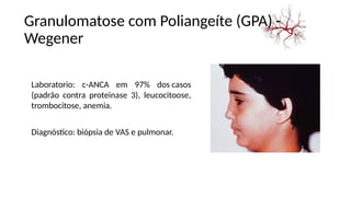 Laboratorio: c-ANCA em 97% dos casos
(padrão contra proteinase 3), leucocitoose,
trombocitose, anemia.
Diagnóstico: biópsia de VAS e pulmonar.
Granulomatose com Poliangeíte (GPA) -
Wegener
 
