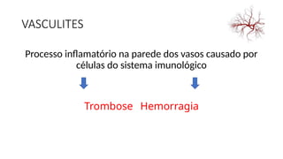 VASCULITES
Processo inflamatório na parede dos vasos causado por
células do sistema imunológico
Trombose Hemorragia
 