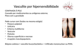 Vasculite por hipersensibilidade
CONFINADA À PELE
Causado por medicamentos ou antígenos externo;
Piora com a gravidade
Pode cursar com (lesões no mesmo estágio)
- Púrpura palpável
- Urticária
- Eritema multiforme
- Vesícular
- Pústulas
- Úlceras superficiais e necrose
- erupções maculopapulares.
Biópsia cutânea-> vasculite leucocitoclástica -> infiltrado mononuclear ou PMN.
 