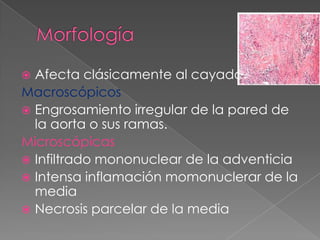  Afecta clásicamente al cayado aórtico
Macroscópicos
 Engrosamiento irregular de la pared de
  la aorta o sus ramas.
Microscópicas
 Infiltrado mononuclear de la adventicia
 Intensa inflamación momonuclerar de la
  media
 Necrosis parcelar de la media
 