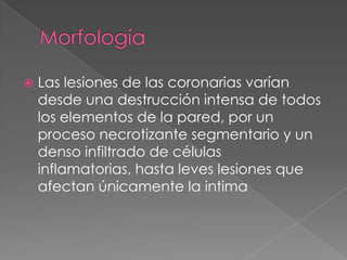    Las lesiones de las coronarias varían
    desde una destrucción intensa de todos
    los elementos de la pared, por un
    proceso necrotizante segmentario y un
    denso infiltrado de células
    inflamatorias, hasta leves lesiones que
    afectan únicamente la intima
 