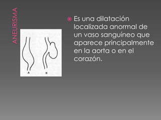    Es una dilatación
    localizada anormal de
    un vaso sanguíneo que
    aparece principalmente
    en la aorta o en el
    corazón.
 
