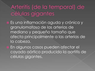  Es una inflamación aguda y crónica y
  granulomatosa de las arterias de
  mediano y pequeño tamaño que
  afecta principalmente a las arterias de
  la cabeza.
 En algunos casos pueden afectar el
  cayado aórtico producido la aortitis de
  células gigantes.
 