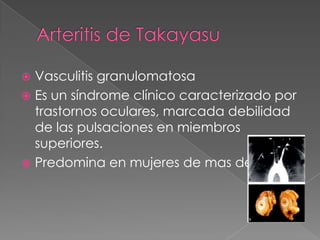  Vasculitis granulomatosa
 Es un síndrome clínico caracterizado por
  trastornos oculares, marcada debilidad
  de las pulsaciones en miembros
  superiores.
 Predomina en mujeres de mas de 40.
 