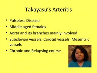 Takayasu’s Arteritis
• Pulseless Disease
• Middle aged females
• Aorta and its branches mainly involved
• Subclavian vessels, Carotid vessels, Mesentric
vessels
• Chronic and Relapsing course
 