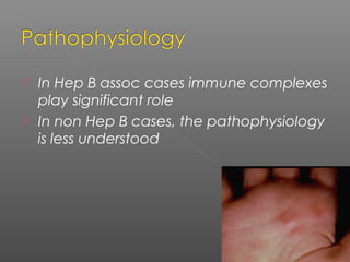  In Hep B assoc cases immune complexes
play significant role
 In non Hep B cases, the pathophysiology
is less understood
 