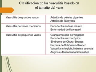 Clasificación de las vasculitis basado en
el tamaño del vaso
 