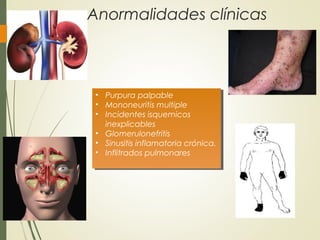 Anormalidades clínicas
• Purpura palpable
• Mononeuritis multiple
• Incidentes isquemicos
inexplicables
• Glomerulonefritis
• Sinusitis inflamatoria crónica.
• Inflitrados pulmonares
• Purpura palpable
• Mononeuritis multiple
• Incidentes isquemicos
inexplicables
• Glomerulonefritis
• Sinusitis inflamatoria crónica.
• Inflitrados pulmonares
 