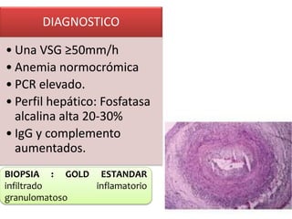 DIAGNOSTICO
• Una VSG ≥50mm/h
• Anemia normocrómica
• PCR elevado.
• Perfil hepático: Fosfatasa
alcalina alta 20-30%
• IgG y complemento
aumentados.
BIOPSIA : GOLD ESTANDAR
infiltrado inflamatorio
granulomatoso
 