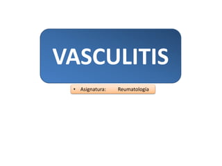 VASCULITIS
• Asignatura: Reumatología
 