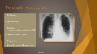 Poliangitis Microscópica
• Definición
• Epidemiología
• Patología
-Afecta capilares, vénulas, A. MP
• Manifestaciones clínicas
• Diagnóstico
• Causa de muerte : Hemorragias
Vasculitis
 