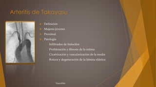 Arteritis de Takayasu
 Definición
 Mujeres jóvenes
 Proximal
 Patología
Infiltrados de linfocitos
Proliferación y fibrosis de la íntima
Cicatrización y vascularización de la media
Rotura y degeneración de la lámina elástica
Vasculitis
 