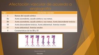 Afectación vascular de acuerdo a
angiografía
Tipo Afectación vascular
I Ramas del cayado aórtico
IIa Aorta ascendente, cayado aórtico y sus ramas.
IIb Aorta ascendente, cayado aórtico y sus ramas. Aorta descendente torácica
III Aorta descendente torácica. Aorta abdominal. Arterias renales
IV Aorta abdominal. Arterias renales
V Características de los IIb y IV
Vasculitis
Takayasu Conference 1994
 