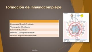 Púrpura de Henoch-Schönlein
Vasculopatía del colágeno
Enfermedad del Suero
Hepatitis C (crioglobulinémica)
Hepatitis B ( panarteristis nodosa)
Vasculitis
 