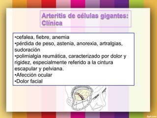 •cefalea, fiebre, anemia
•pérdida de peso, astenia, anorexia, artralgias,
sudoración
•polimialgia reumática, caracterizado por dolor y
rigidez, especialmente referido a la cintura
escapular y pelviana.
•Afección ocular
•Dolor facial
 
