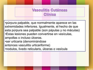 •púrpura palpable, que normalmente aparece en las
extremidades inferiores. Igualmente, el hecho de que
esta púrpura sea palpable (son pápulas y no máculas)
•Estas lesiones pueden convertirse en vesículas,
ampollas o incluso úlceras.
•ser urticaria (denominándose
entonces vasculitis urticariforme)
•nodulos, livedo reticularis, úlceras o vesícula
 
