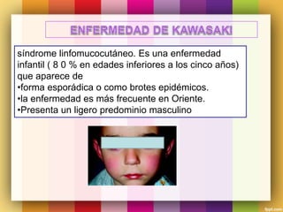 síndrome linfomucocutáneo. Es una enfermedad
infantil ( 8 0 % en edades inferiores a los cinco años)
que aparece de
•forma esporádica o como brotes epidémicos.
•la enfermedad es más frecuente en Oriente.
•Presenta un ligero predominio masculino
 