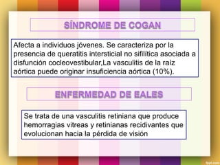 Afecta a individuos jóvenes. Se caracteriza por la
presencia de queratitis intersticial no sifilítica asociada a
disfunción cocleovestibular,La vasculitis de la raíz
aórtica puede originar insuficiencia aórtica (10%).
Se trata de una vasculitis retiniana que produce
hemorragias vitreas y retinianas recidivantes que
evolucionan hacia la pérdida de visión
 