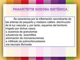 Se caracteriza por la inflamación necrotizante de
las arterias de pequeño y mediano calibre. disminución
de la luz vascular y, por tanto, isquemia del territorio
irrigado por dichos vasos.
ausencia de granulomas
Ausencia de eosinófilos
formación de microaneurismas
infiltrado de polimorfonucleares
la necrosis fibrinoide
 