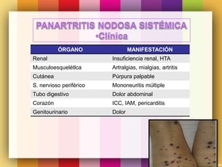 ÓRGANO MANIFESTACIÓN
Renal Insuficiencia renal, HTA
Musculoesquelétlca Artralgias, mialgias, artritis
Cutánea Púrpura palpable
S. nervioso periférico Mononeuritis múltiple
Tubo digestivo Dolor abdominal
Corazón ICC, IAM, pericarditis
Genitourinario Dolor
 