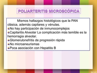 Mismos hallazgos histológicos que la PAN
clásica, además capilares y vénulas.
No hay participación de inmunocomplejos
Capilaritis Alveolar La complicación más temible es la
hemorragia alveolar.
Glomerulonefritis de progresión rápida
No microaneurismas
Poca asociación con Hepatitis B
 