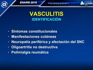 VASCULITIS
IDENTIFICACIÓN
• Síntomas constitucionales
• Manifestaciones cutáneas
• Neuropatía periférica y afectación del SNC
• Oligoartritis no destructiva
• Polimialgia reumática
 